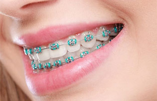 Best Dentist & Dental Clinic in Bandra & Chembur