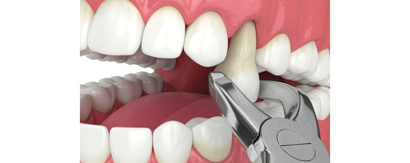 Oral and Maxillofacial surgeon in Bandra